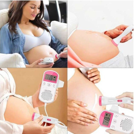 Monitor Fetal Doppler, Cyrax, Monitorizare Sarcina, Ritm Cardiac, Ecran LCD 4.5 cm, 2 x Baterii AA (neincluse), Portabil, din ABS, 12.8 x 9.6 x 3 cm, Utilizare de la 9 Saptamani, Roz